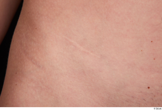 Vinna Reed nude scar skin 0001.jpg